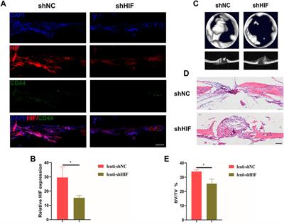 HIF-1α Regulates Osteogenesis of Periosteum-Derived Stem Cells Under Hypoxia Conditions via Modulating POSTN Expression